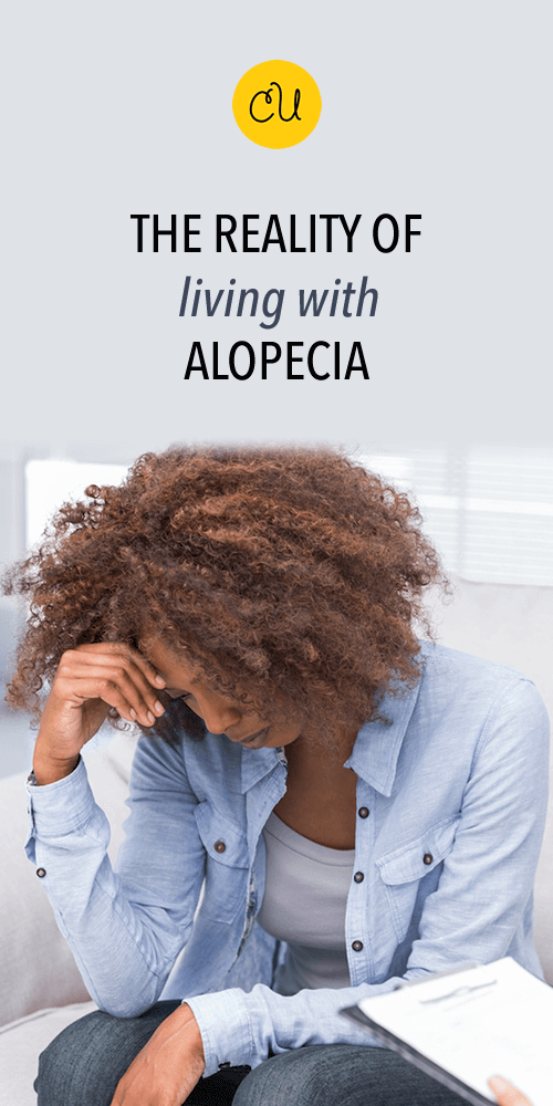 living with alopecia